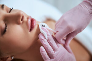 Close up of a woman lying with her eyes closed during her lip injections